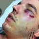 Illustration for article titled The US Marine Behind This Brutal Attack On A Cab Driver Wont Be Charged With A Felony